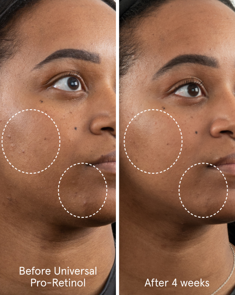 Universal Pro-Retinol - Image 3