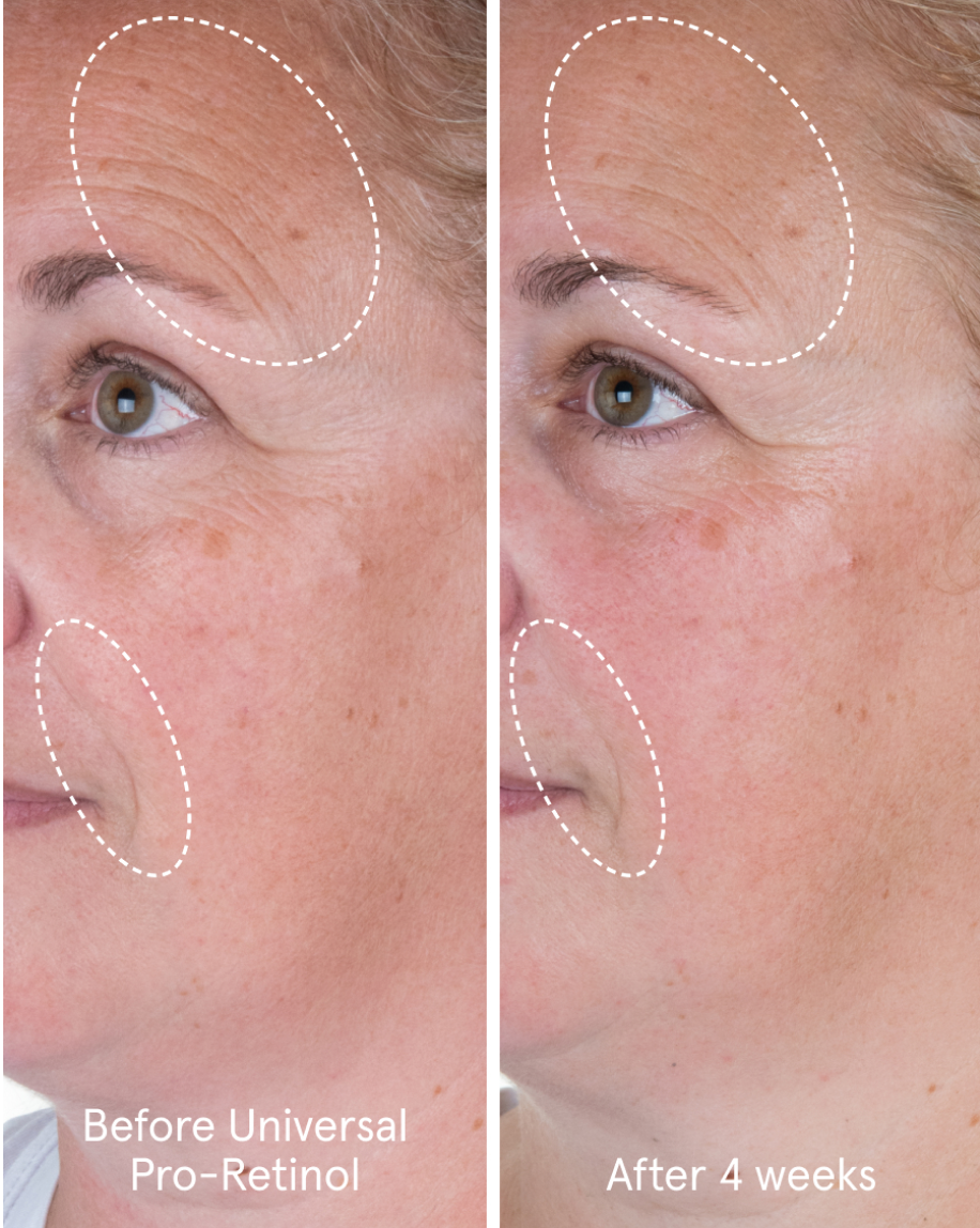 Universal Pro-Retinol - Image 6