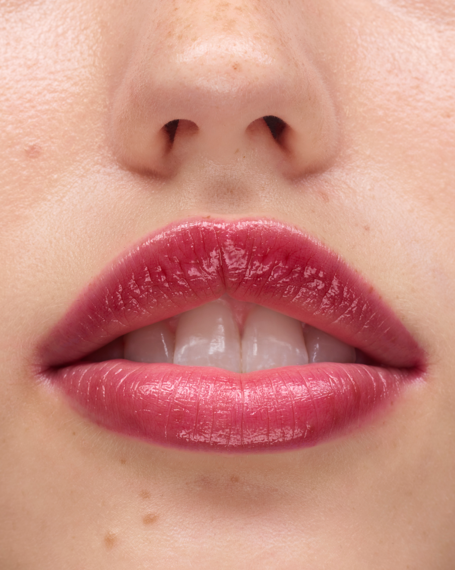 Ultralip - Image 58